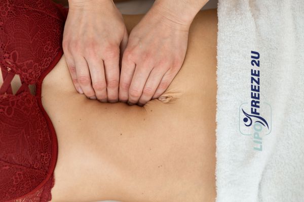 diastasis recti treatment Brentford