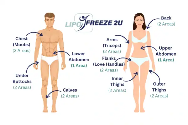 Areas you can have fat freezing treatment Brentford