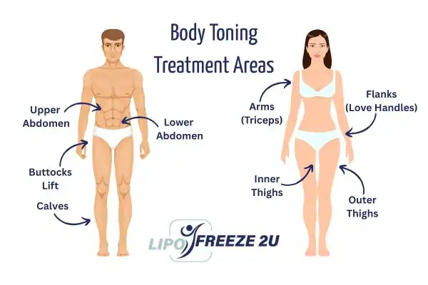 Graphic showing where you can have Body toning Treatment Brentford on your body