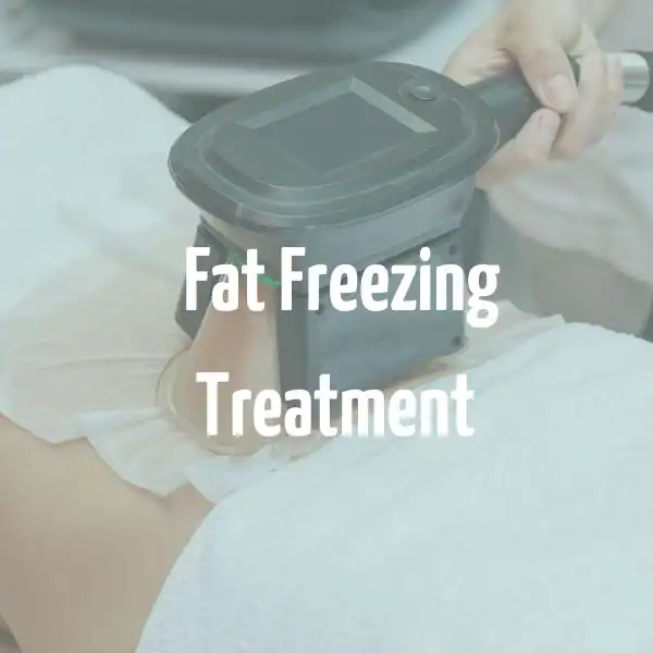 fat freezing treatment Brentford