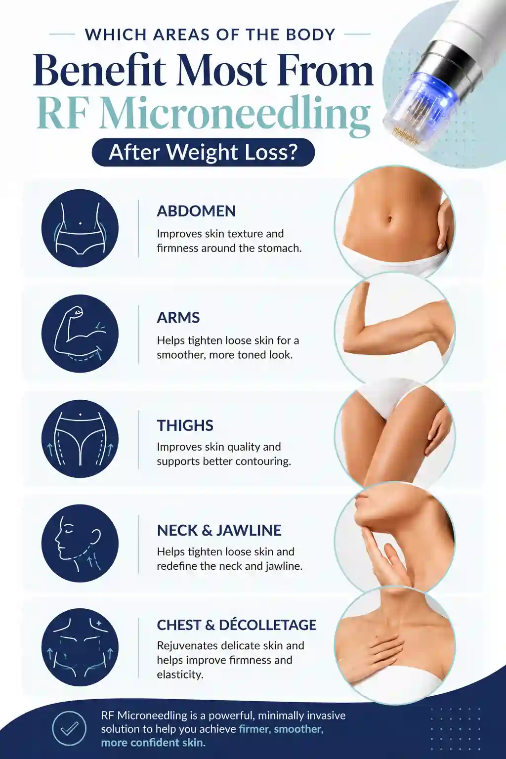 Which Areas of the Body Benefit Most From RF Microneedling After Weight Loss Brentford